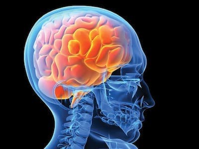 Лечение последствий закрытых черепно-мозговых травм